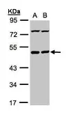 Anti-PSKH1 antibody used in Western Blot (WB). GTX103525