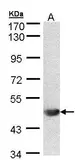 Anti-ALG1 antibody [N1C2] used in Western Blot (WB). GTX103537