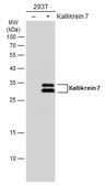 Anti-Kallikrein 7 antibody used in Western Blot (WB). GTX103548