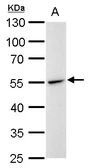 Anti-Desmin antibody used in Western Blot (WB). GTX103557