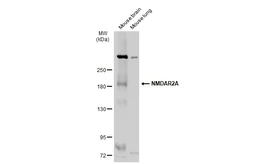 Anti-NMDAR2A antibody used in Western Blot (WB). GTX103558