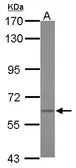 Anti-Asparagine synthetase antibody [N3C3] used in Western Blot (WB). GTX103569