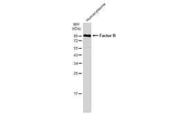 Anti-Factor B antibody [N2C2], Internal used in Western Blot (WB). GTX103570