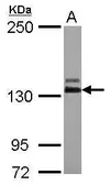 Anti-ABL2 antibody [N1N3] used in Western Blot (WB). GTX103584