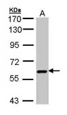 Anti-UAP1 antibody [N1C3] used in Western Blot (WB). GTX103592