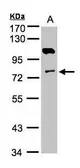 Anti-Adenylate kinase 7 antibody [N2C3] used in Western Blot (WB). GTX103600
