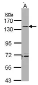 Anti-CD22 antibody [N2C3] used in Western Blot (WB). GTX103601