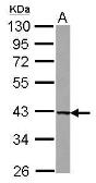 Anti-UROD antibody [N3C3] used in Western Blot (WB). GTX103610