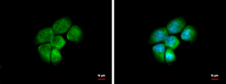 Anti-HSD3a antibody [N1C2] used in Immunocytochemistry/ Immunofluorescence (ICC/IF). GTX103613