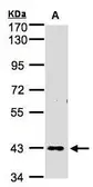 Anti-ZNF211 antibody [N3C2], Internal used in Western Blot (WB). GTX103624