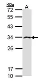 Anti-IMPA2 antibody [N1C3] used in Western Blot (WB). GTX103636