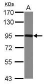Anti-Nectin 3 antibody used in Western Blot (WB). GTX103654
