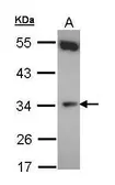 Anti-CYB5R1 antibody [N1C3] used in Western Blot (WB). GTX103657