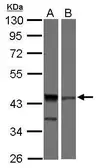 Anti-ICAD antibody [N1C3] used in Western Blot (WB). GTX103668