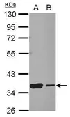 Anti-HSF2BP antibody used in Western Blot (WB). GTX103673