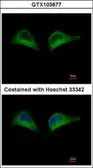 Anti-PSMD7 antibody used in Immunocytochemistry/ Immunofluorescence (ICC/IF). GTX103677
