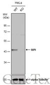 Anti-MPI antibody used in Western Blot (WB). GTX103682