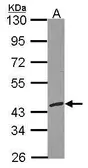 Anti-RFC3 antibody used in Western Blot (WB). GTX103706