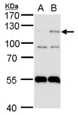 Anti-HIF2 alpha antibody [N1N3] used in Western Blot (WB). GTX103707
