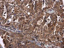 Anti-CYP27A1 antibody used in IHC (Paraffin sections) (IHC-P). GTX103718