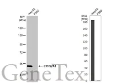 Anti-CYP27A1 antibody used in Western Blot (WB). GTX103718