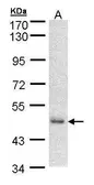 Anti-DNAJA2 antibody [N2C3] used in Western Blot (WB). GTX103734