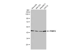 Anti-PRMT2 antibody [N1C2] used in Western Blot (WB). GTX103749
