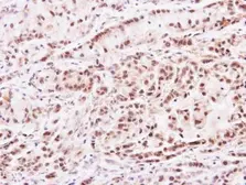 Anti-PRMT2 antibody [N1C2] used in IHC (Paraffin sections) (IHC-P). GTX103749