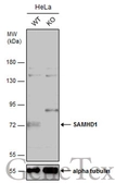 Anti-SAMHD1 antibody [N2C2], Internal used in Western Blot (WB). GTX103751