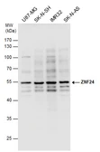 Anti-ZNF24 antibody used in Western Blot (WB). GTX103755