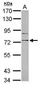 Anti-RP105 antibody [N2C2], Internal used in Western Blot (WB). GTX103761