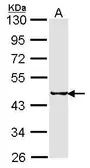 Anti-SEPHS2 antibody used in Western Blot (WB). GTX103766