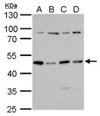 Anti-PKA R2 antibody used in Western Blot (WB). GTX103780