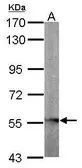 Anti-GLYCTK antibody [N2C3] used in Western Blot (WB). GTX103789