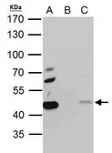 Anti-EBP1 antibody used in Immunoprecipitation (IP). GTX103791