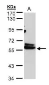 Anti-TCP1 delta antibody [N2C3] used in Western Blot (WB). GTX103795