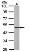 Anti-ZNF140 antibody [N1C3] used in Western Blot (WB). GTX103803