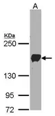 Anti-PCDH1 antibody [N1N3] used in Western Blot (WB). GTX103806