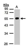 Anti-Angiotensinogen antibody [N1C3] used in Western Blot (WB). GTX103824