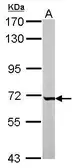 Anti-GCKR antibody [N1C3] used in Western Blot (WB). GTX103836