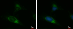 Anti-UGCGL2 antibody [N3C2], Internal used in Immunocytochemistry/ Immunofluorescence (ICC/IF). GTX103837