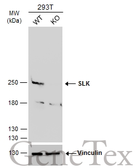 Anti-SLK antibody used in Western Blot (WB). GTX103840