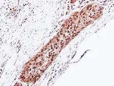 Anti-PSMA5 antibody used in IHC (Paraffin sections) (IHC-P). GTX103845
