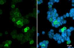 Anti-GNAL antibody used in Immunocytochemistry/ Immunofluorescence (ICC/IF). GTX103863