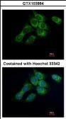 Anti-HSD17B4 antibody used in Immunocytochemistry/ Immunofluorescence (ICC/IF). GTX103864