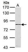 Anti-HSD17B4 antibody used in Western Blot (WB). GTX103864