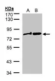 Anti-Dishevelled 2 antibody [N2C2], Internal used in Western Blot (WB). GTX103878