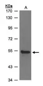 Anti-ZNF157 antibody [N3C3] used in Western Blot (WB). GTX103880