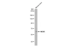 Anti-NOX1 antibody used in Western Blot (WB). GTX103888
