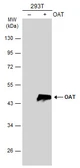 Anti-OAT antibody [N1C3] used in Western Blot (WB). GTX103893